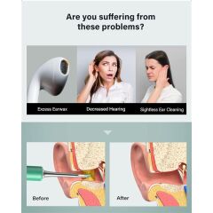 Bebird T5 Görüntülü Kulak Temizleyici 3 MP Kamera 3.5 mm Lens Wi‑Fi Bağlantı Şarjlı 250 mAh 6 LED 20× Büyütme IP67 Suya Dayanıklı Yeşil